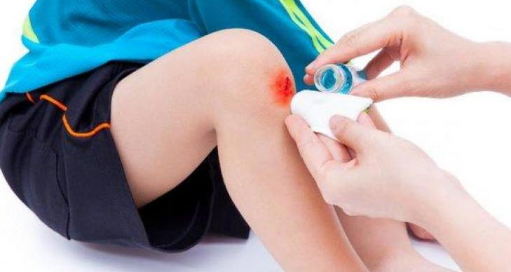 راههای توقف خونریزی های کوچک