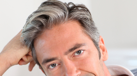 سفید شدن مو در جوانی به چه عواملی بستگی دارد؟